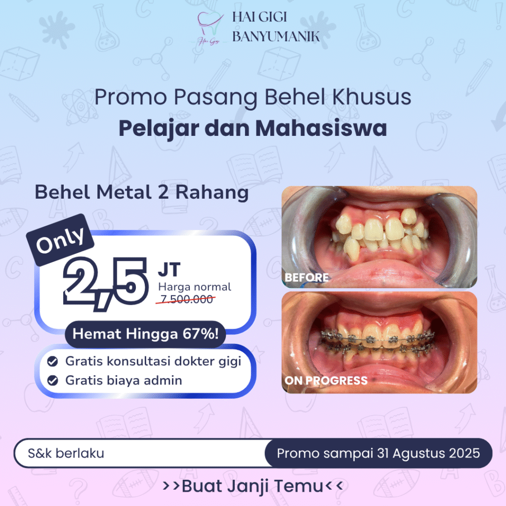behel-pelajar-hai-gigi-banyumanik