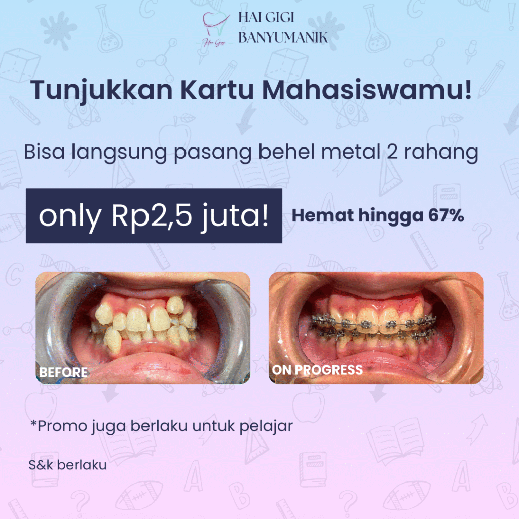 Promo Behel Mahasiswa