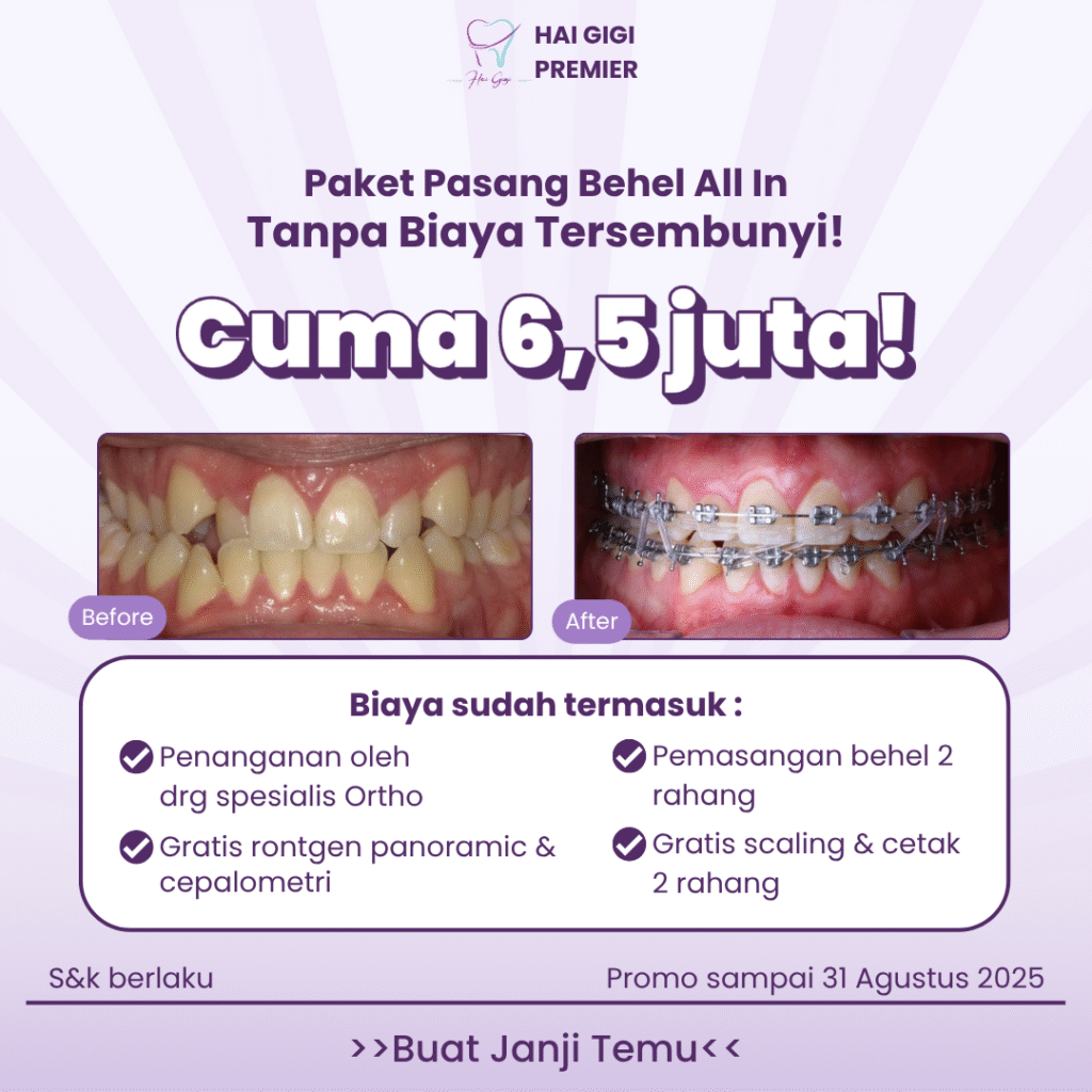 paket-behel-hai-gigi-premier
