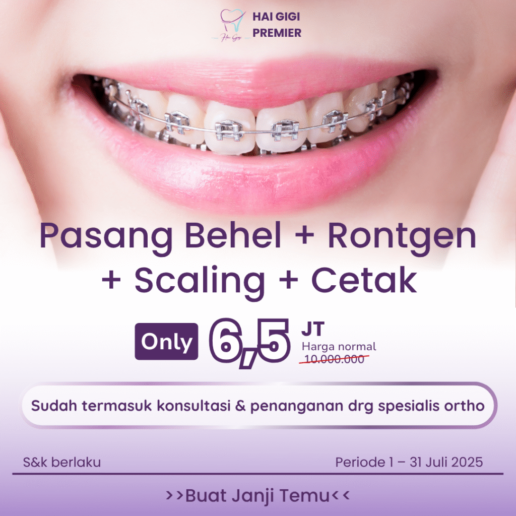 Promo paket-behel-lengkap-hai-gigi-premier