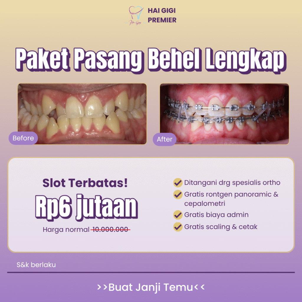 paket-behel-lengkap-hai-gigi-premier