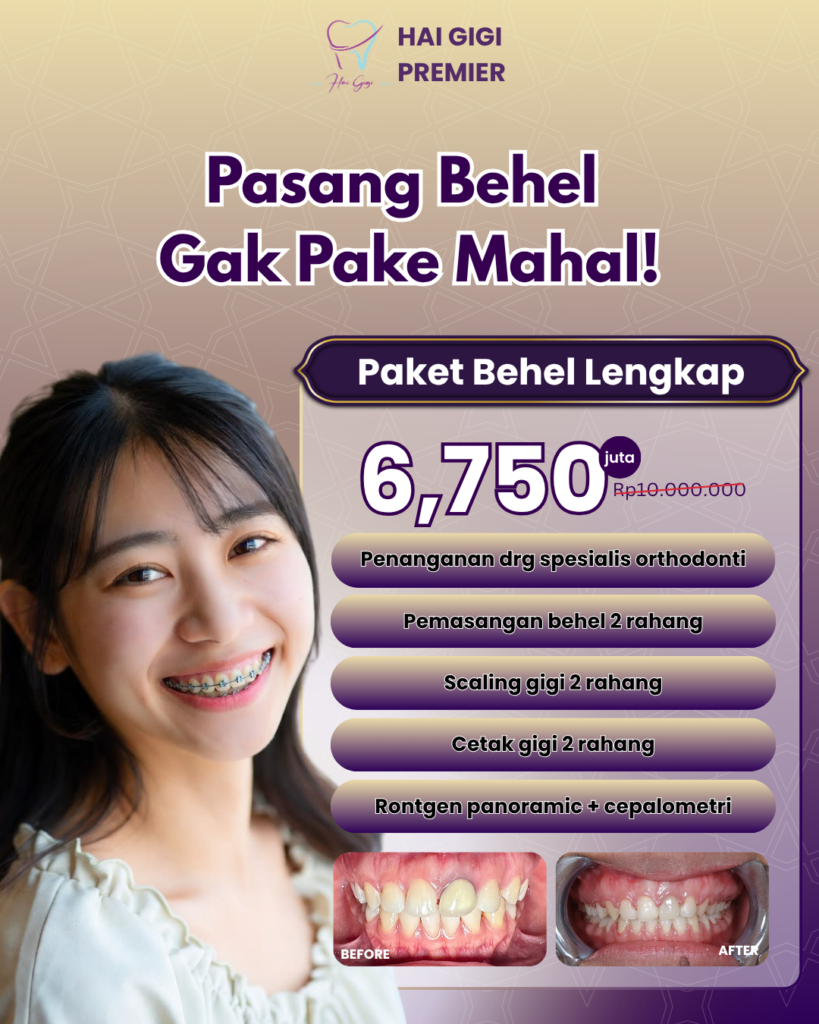 paket-behel-lengkap-hai-gigi-premier