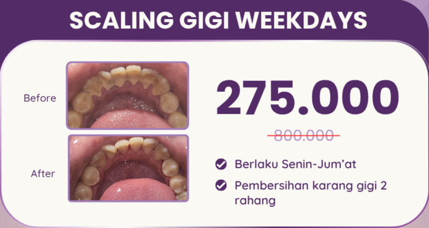 scaling-gigi-weekdays-hai-gigi-premier