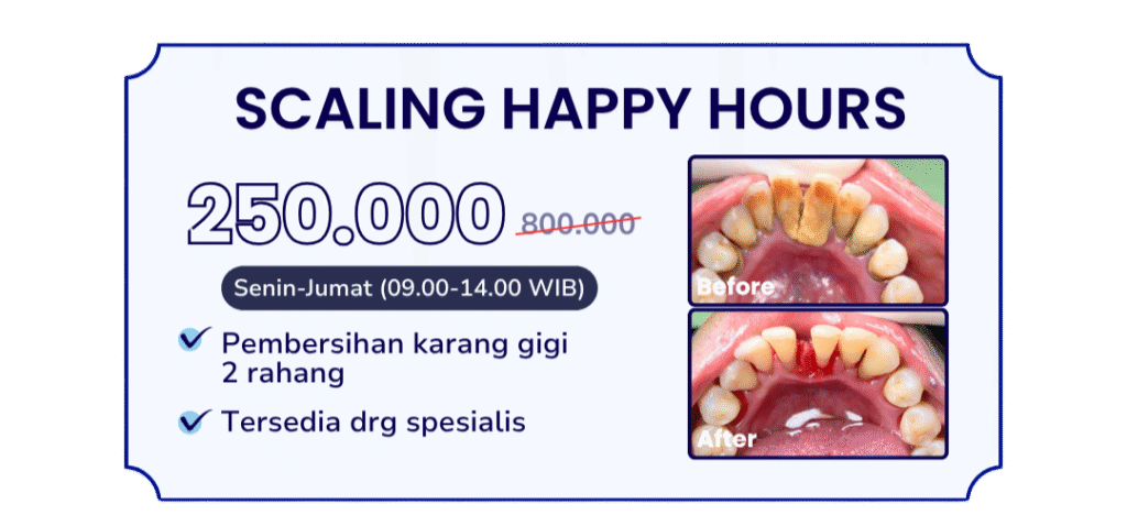 scaling-happy-hours-hai-gigi-banyumani