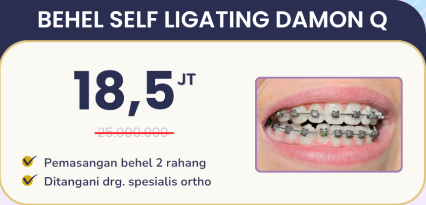 Promo behel self ligating damon Q