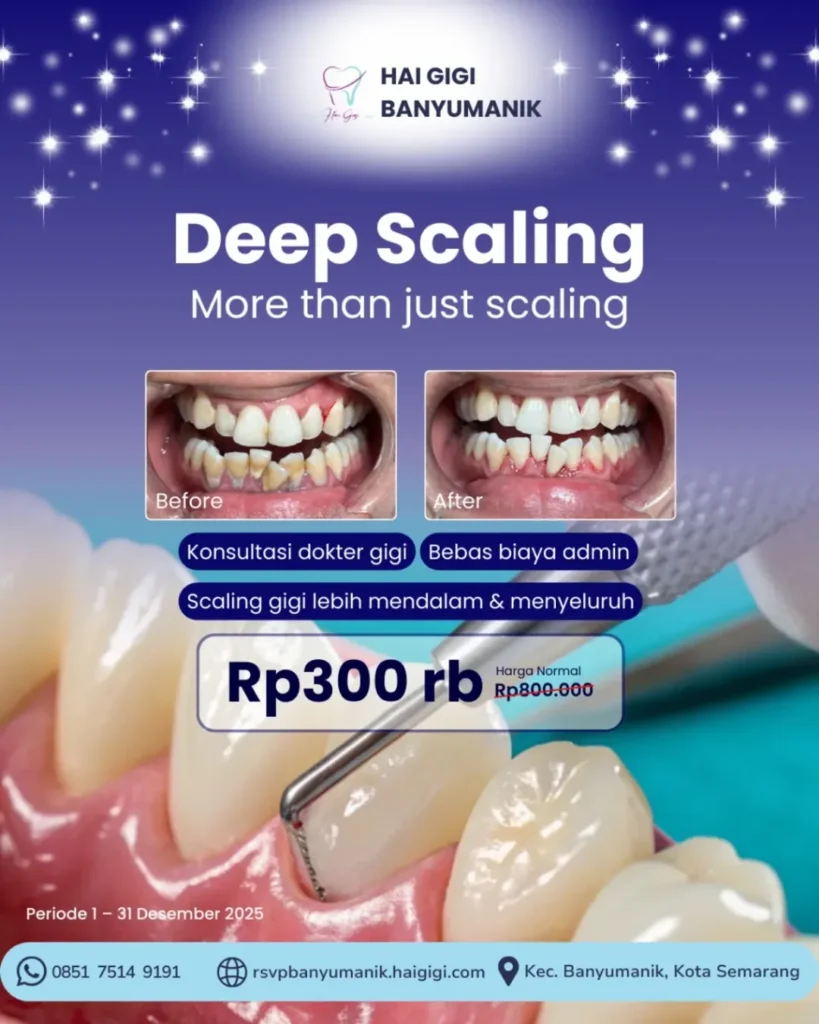 promo-scaling-hai-gigi-banyumanik