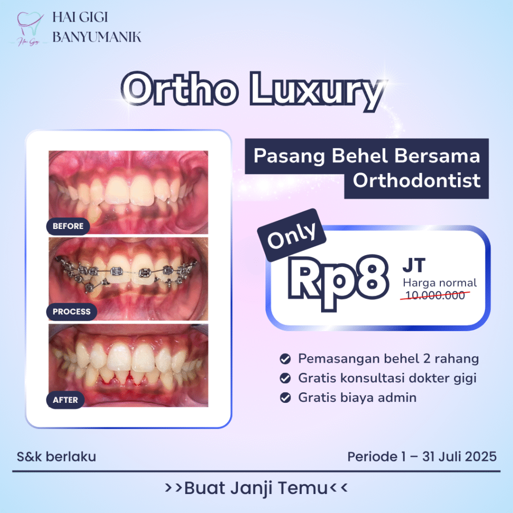 Promo behel-luxury-hai-gigi-banyumanik