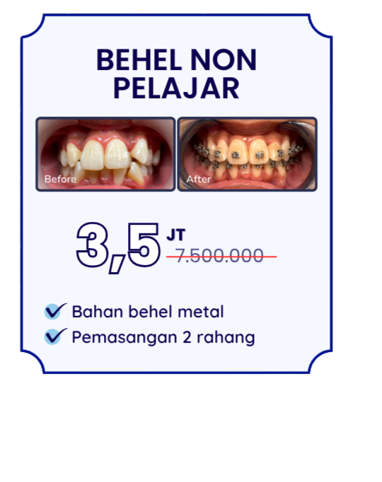 behel-non-pelajar-hai-gigi-banyumanik