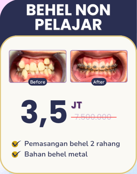 Promo behel non pelajar hai gigi banyumanik