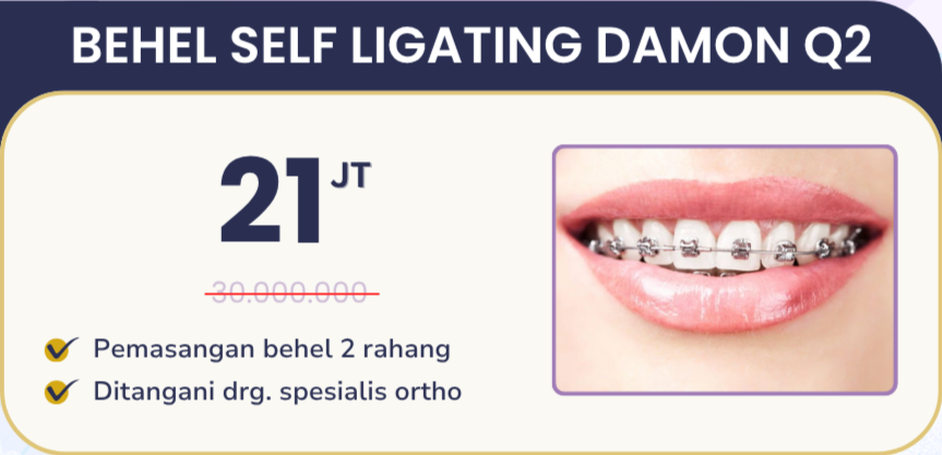 Promo behel self ligating damon Q2 hai gigi banyumanik