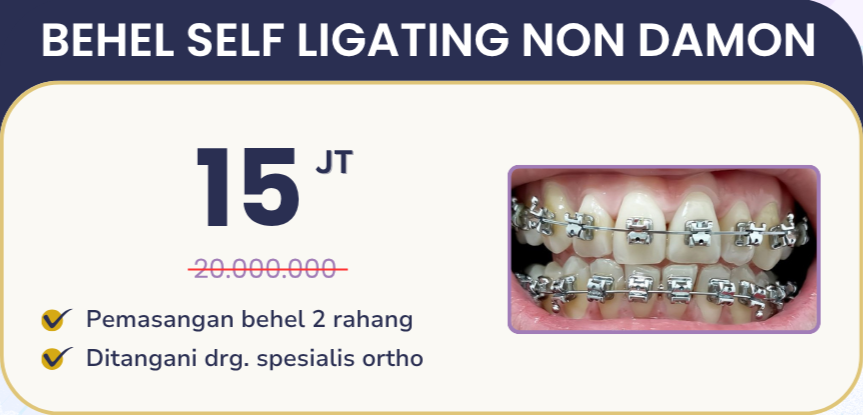 Promo behel self ligating non damon hai gigi banyumanik