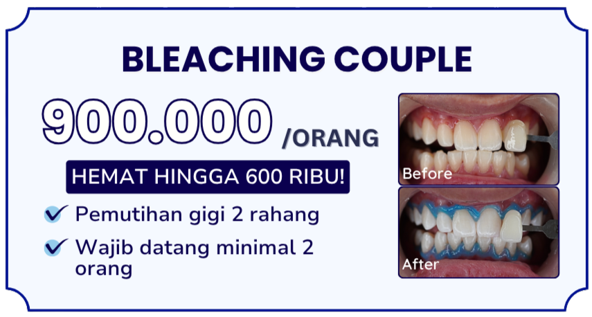 bleaching-couple-hai-gigi-banyumanik
