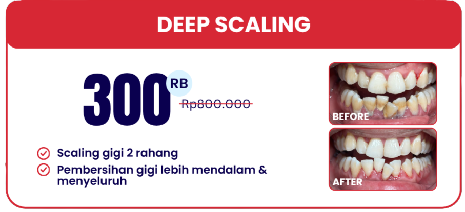 deep-scaling-hai-gigi-banyumanik
