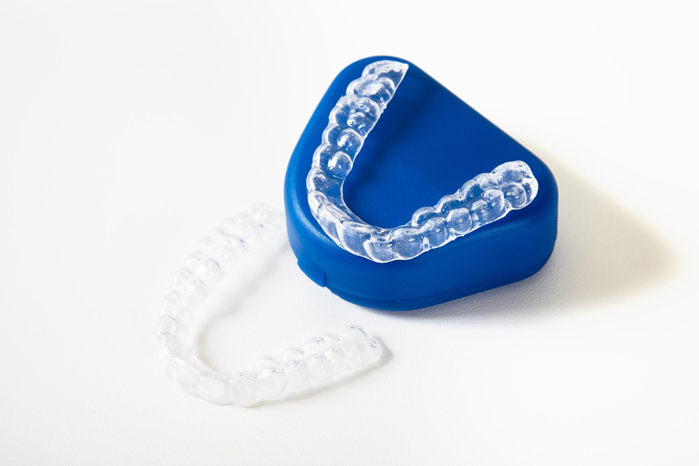 4 Penyebab Gigi Tonggos dan Cara Merapikannya invisalign untuk gigi tonggos