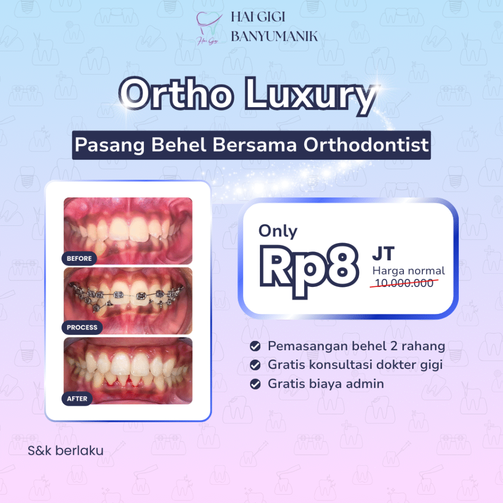 Promo Behel Luxury
