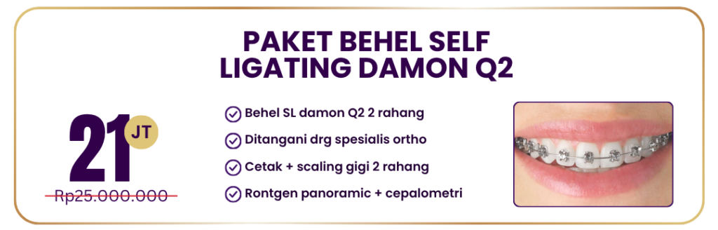 paket-behel-self-ligating-damon-q2-hai-gigi-premier