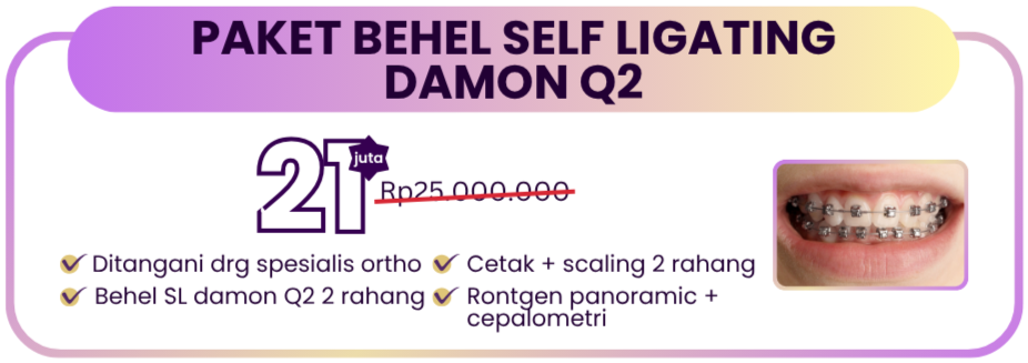 paket-behel-self-ligating-damon-q2-hai-gigi-premier