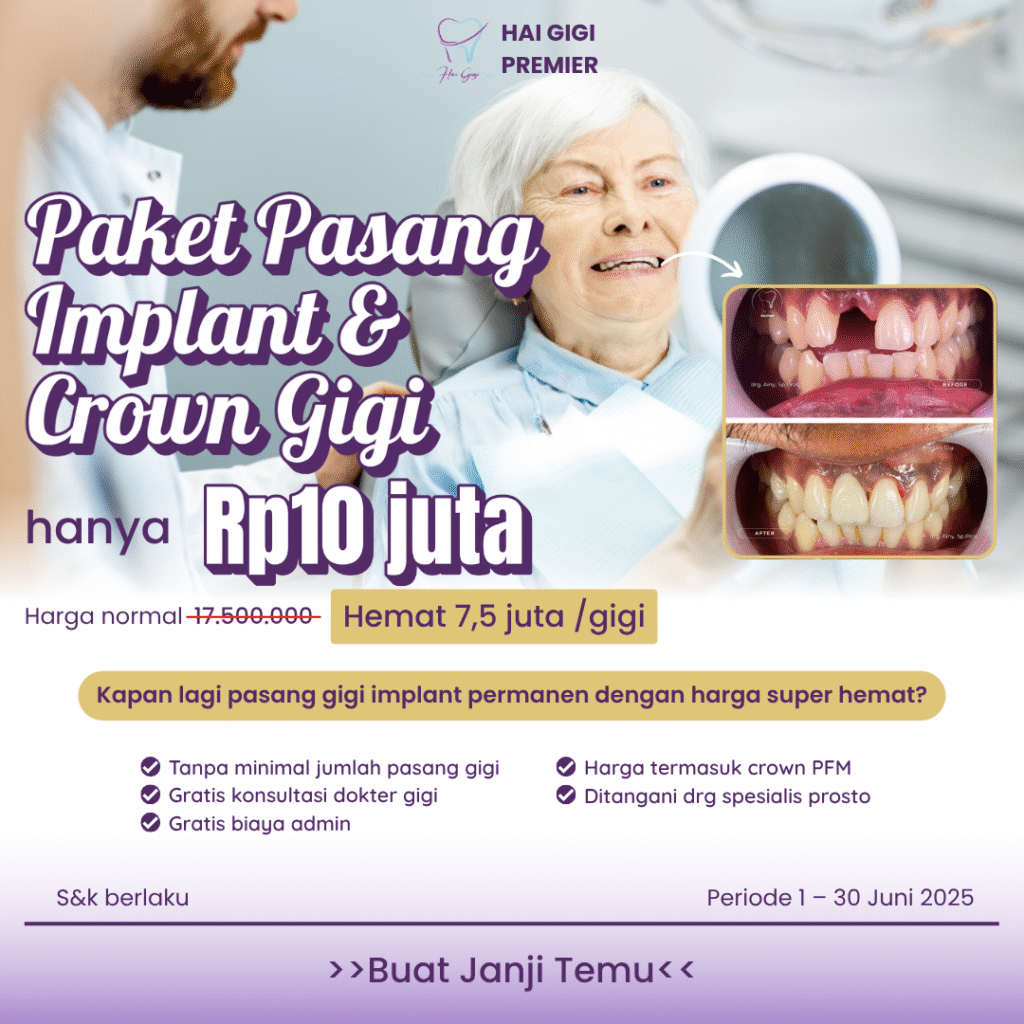 paket-pasang-implan-dan-crown-gigi-hai-gigi-premier