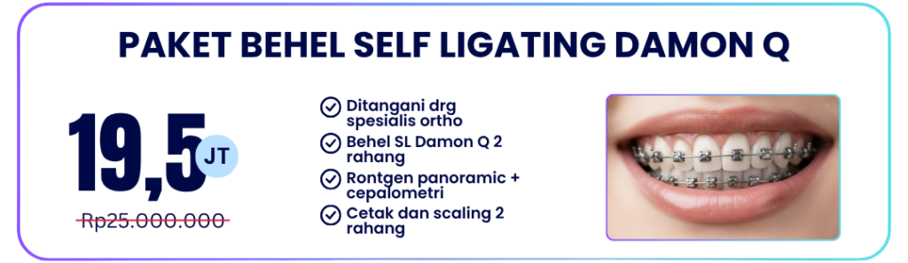 paket-self-ligating-damon-q