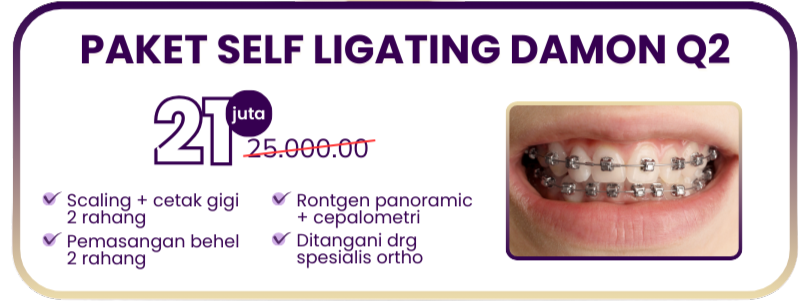 paket-self-ligating-damon-q2-hai-gigi-premier