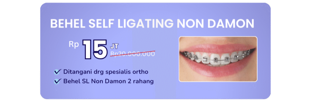 promo-behel-self-ligating-non-damon-hai-gigi-banyumanik