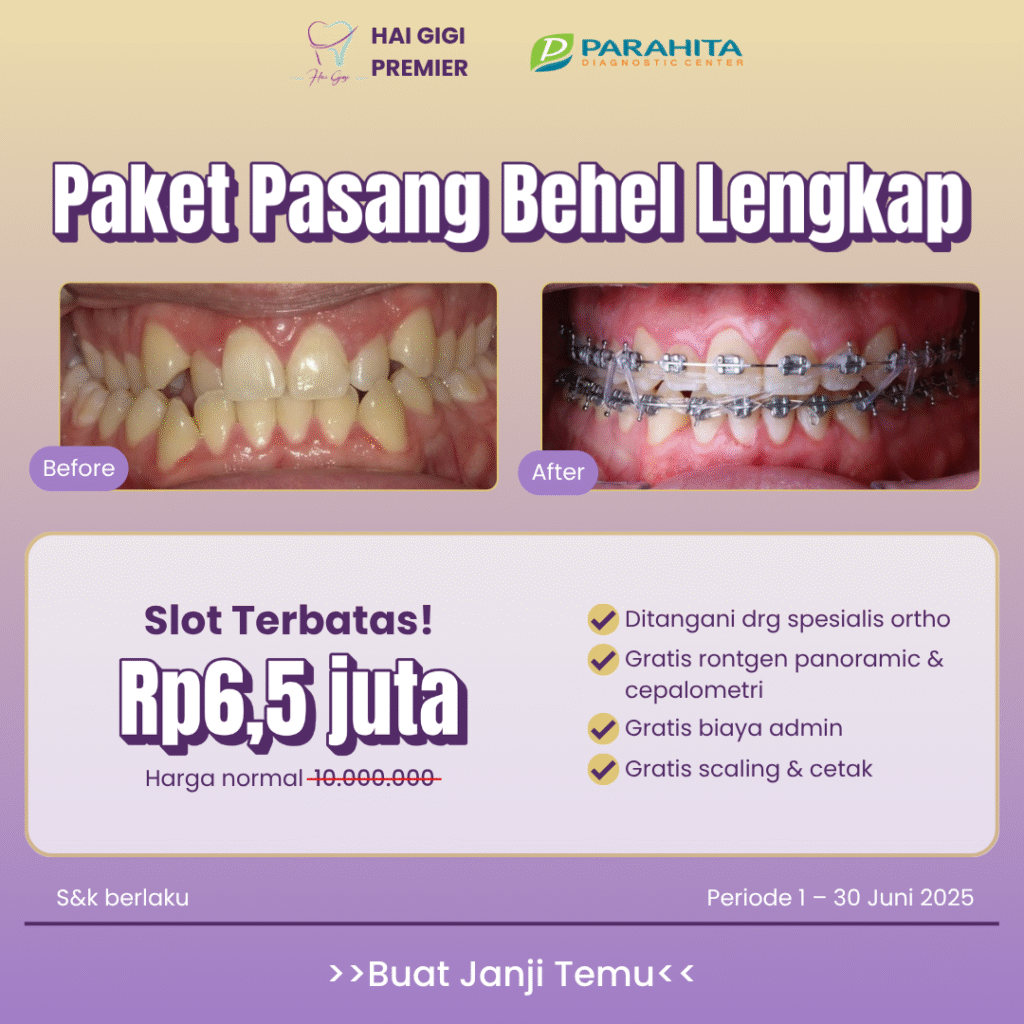 promo-paket-behel-lengkap-hai-gigi-premier