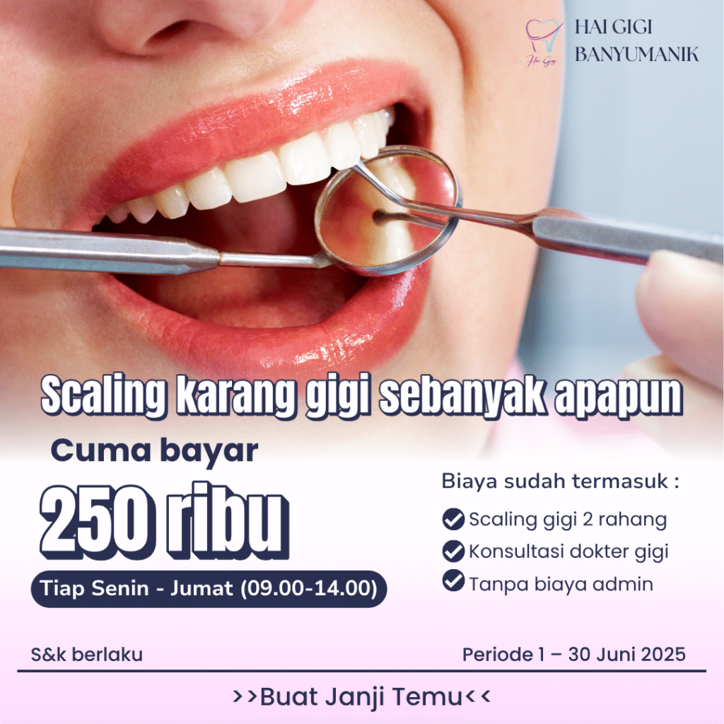 promo-scaling-hai-gigi-banyumanik