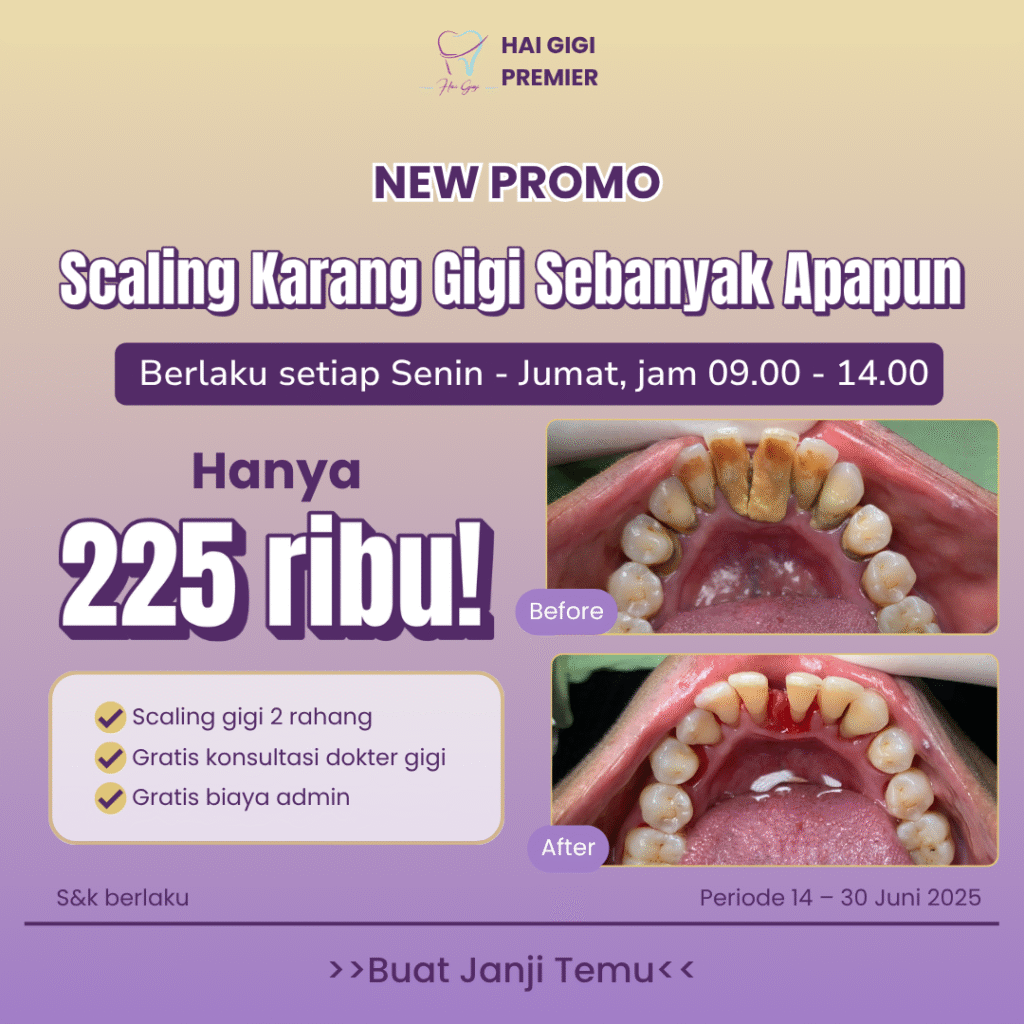 promo-scaling-hai-gigi-premier