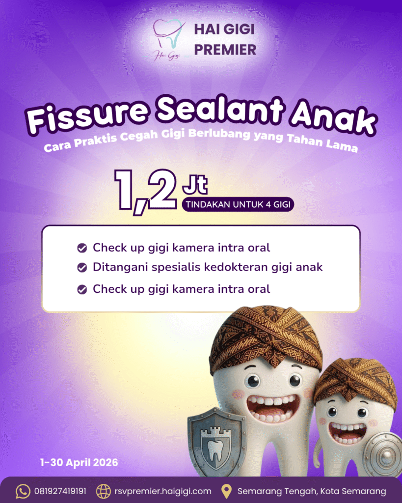 fissure-sealant-anak-hai-gigi-premier