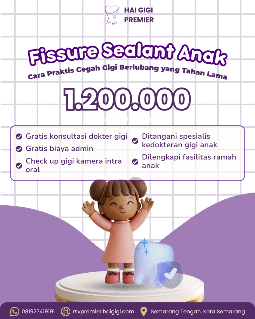 fissure-sealant-anak-hai-gigi-premier