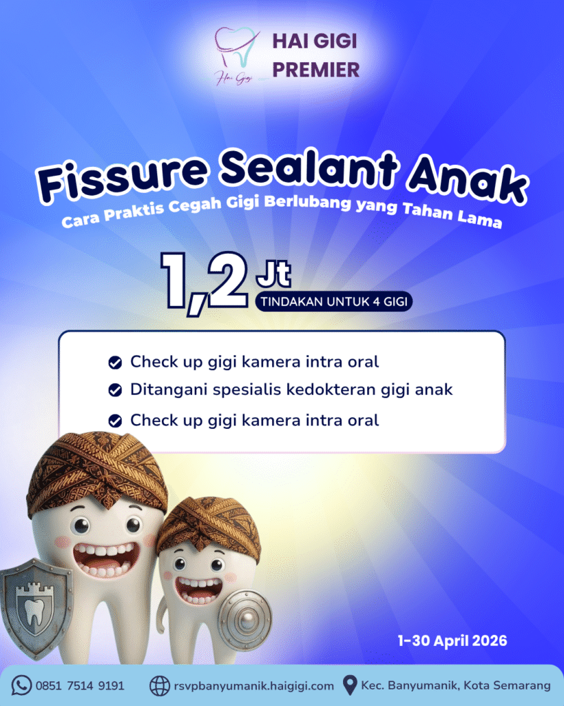fissure-sealant-anak-hai-gigi-banyumanik