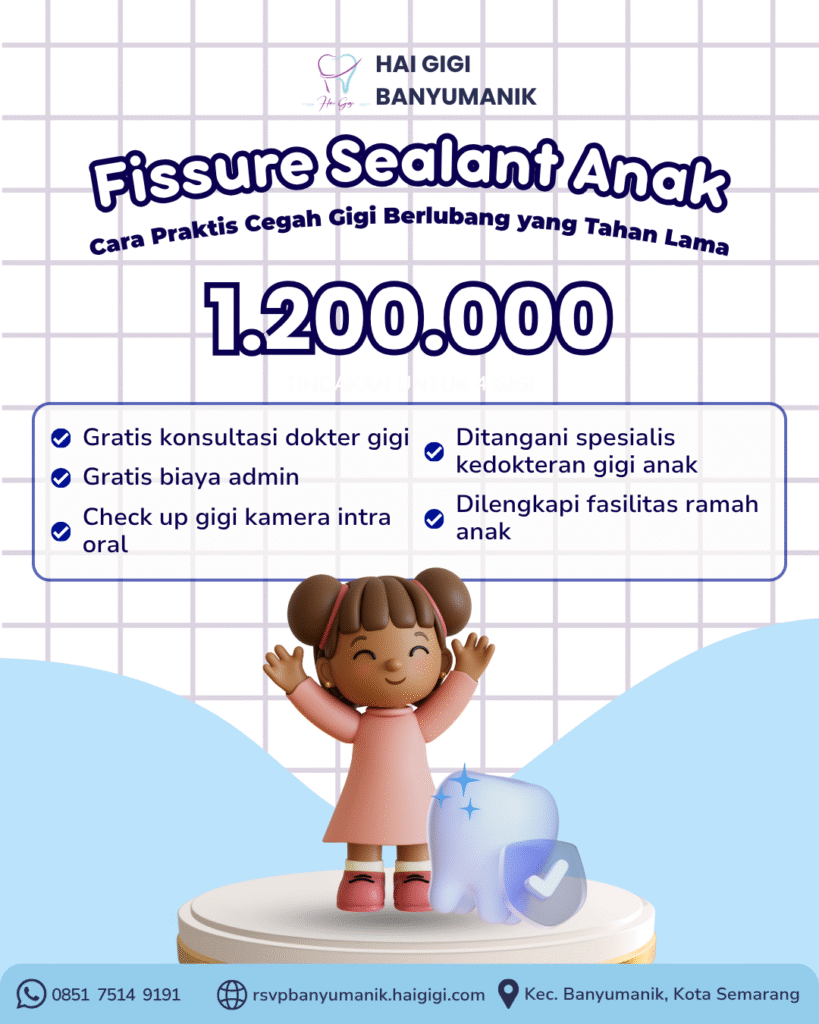 fissure-sealant-hai-gigi-banyumanik