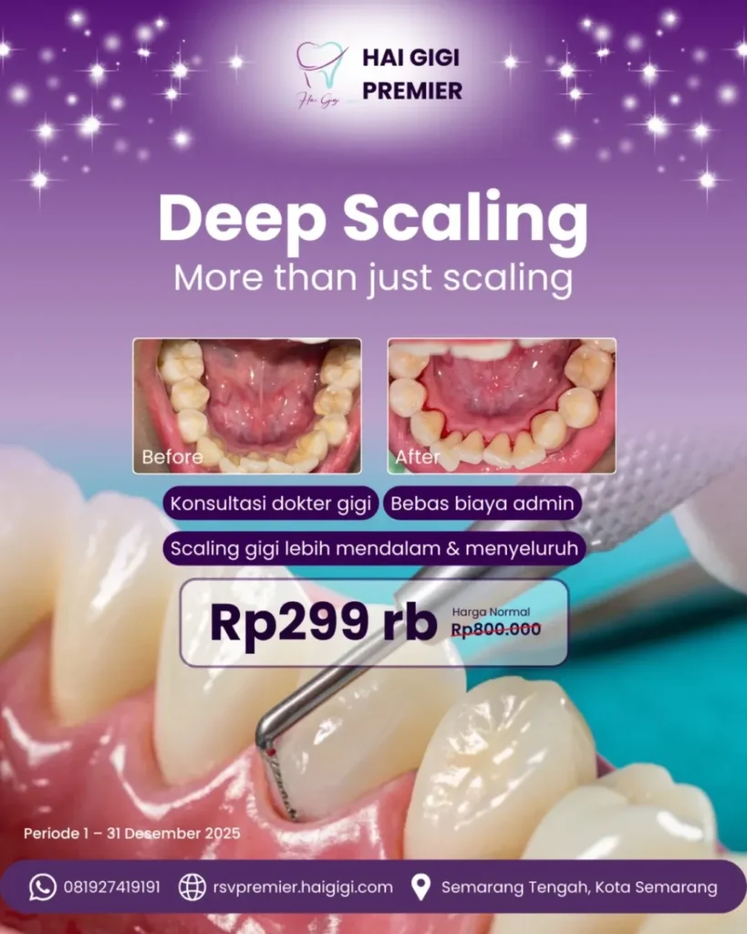 promo-scaling-hai-gigi-premier