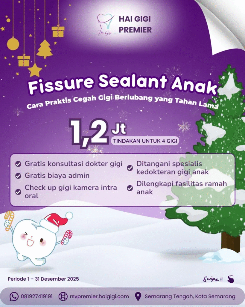 promo-fissure-sealant-anak-hai-gigi-premier
