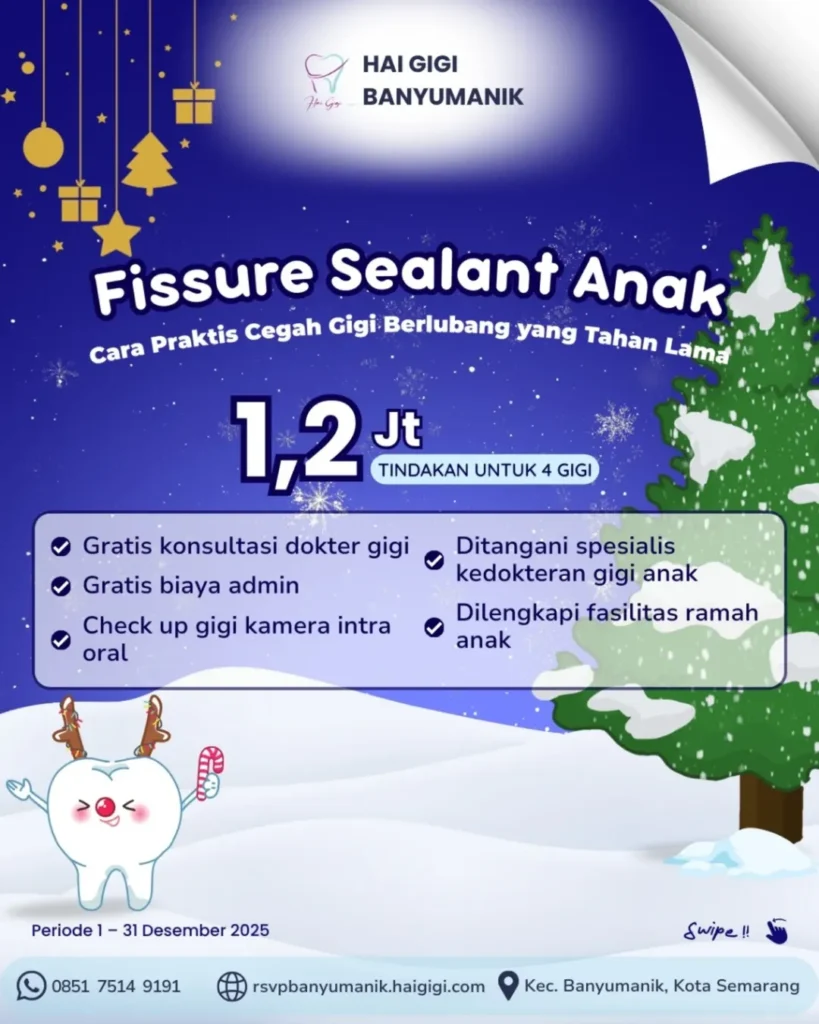 promo-fissure-sealant-anak-hai-gigi-banyumanik