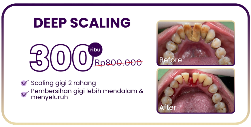 deep-scaling-hai-gigi-premier