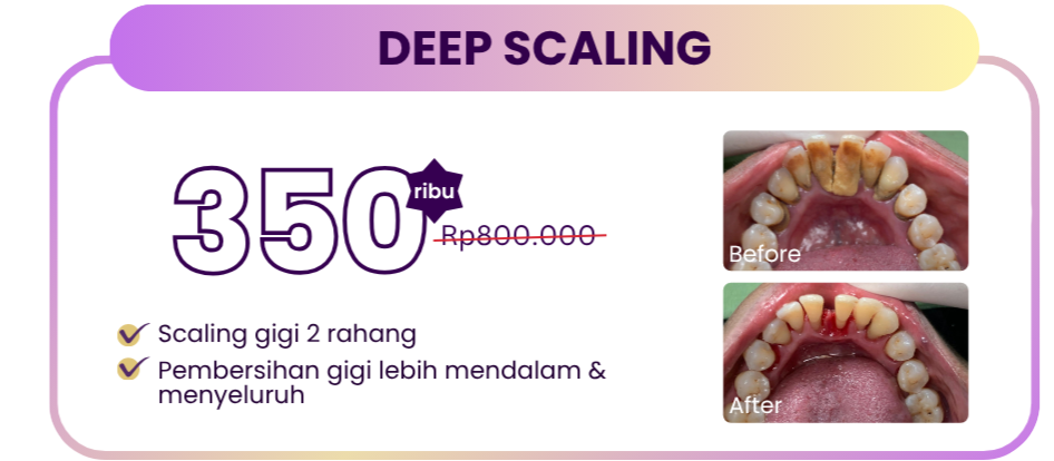 deep-scaling-hai-gigi-premier