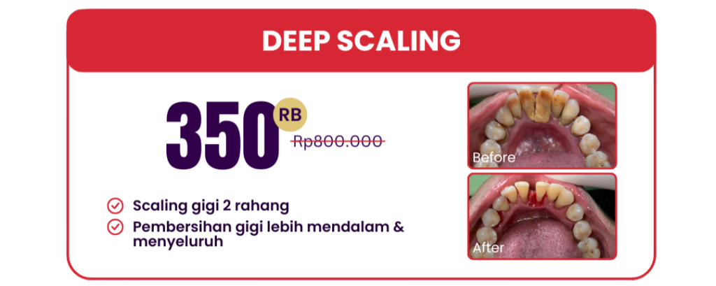 deep-scaling-hai-gigi-premier