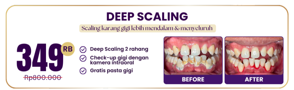 deep-scaling-hai-gigi-premier