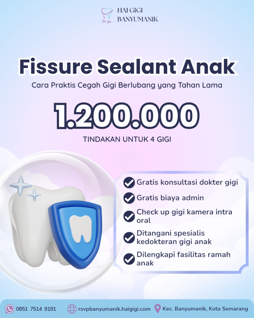 Perawatan Gigi Anak fissure sealant anak