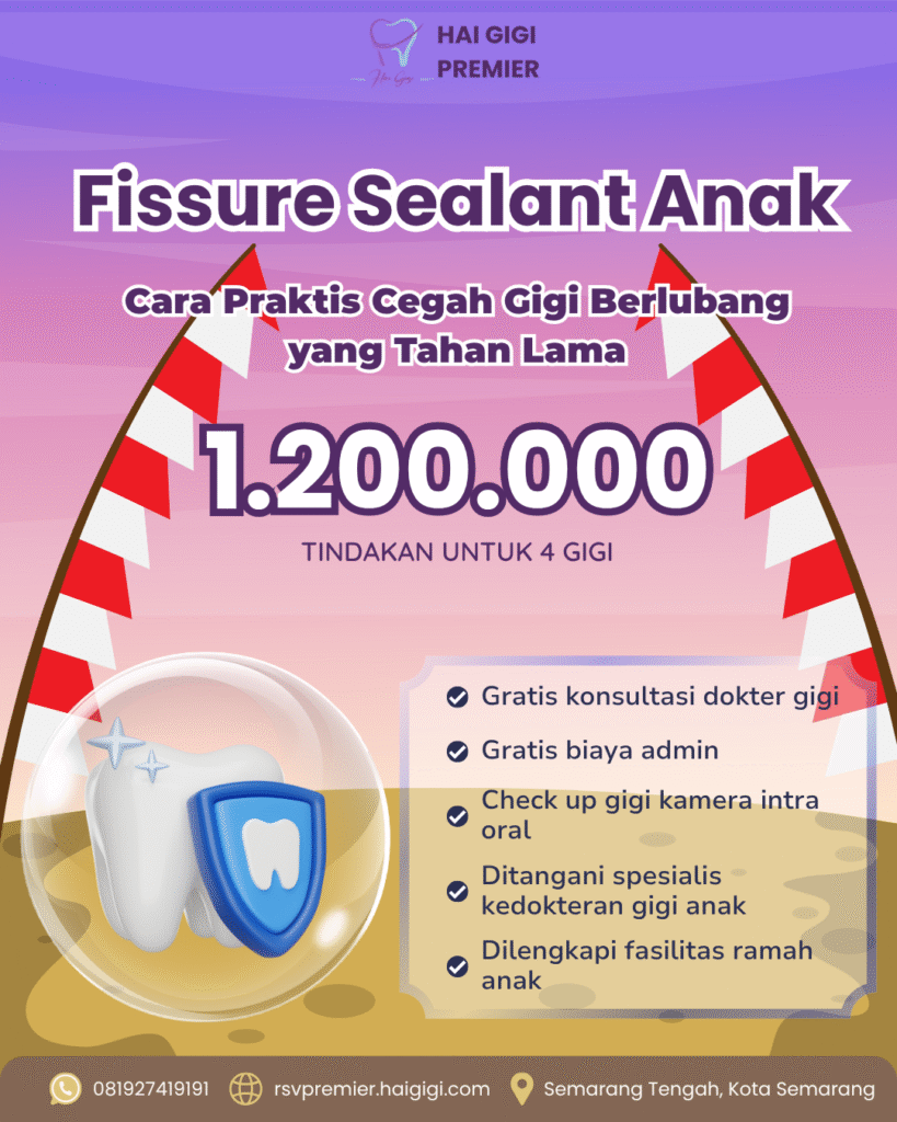 fissure-sealant-anak-hai-gigi-premier