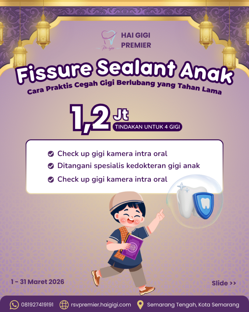 fissure-sealant-anak-hai-gigi-premier