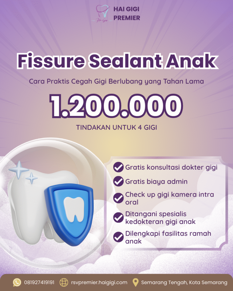 Perawatan Gigi Anak fissure sealant anak hai gigi premier