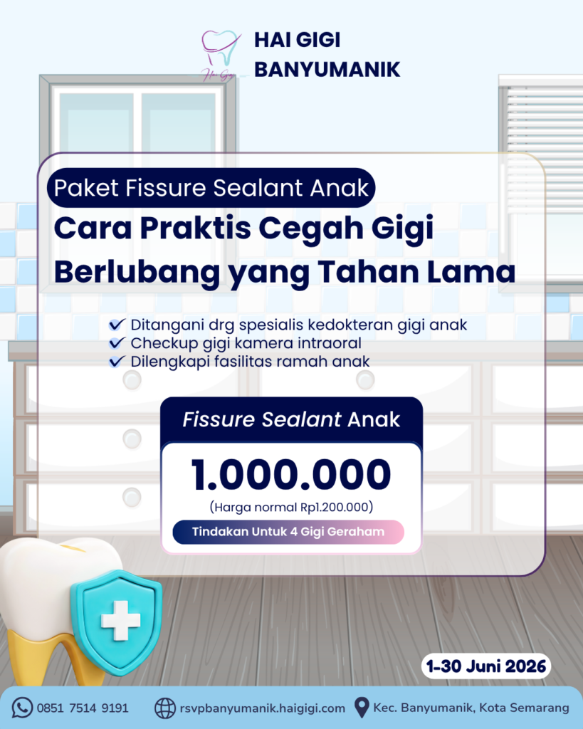 fissure-sealant-hai-gigi-banyumanik