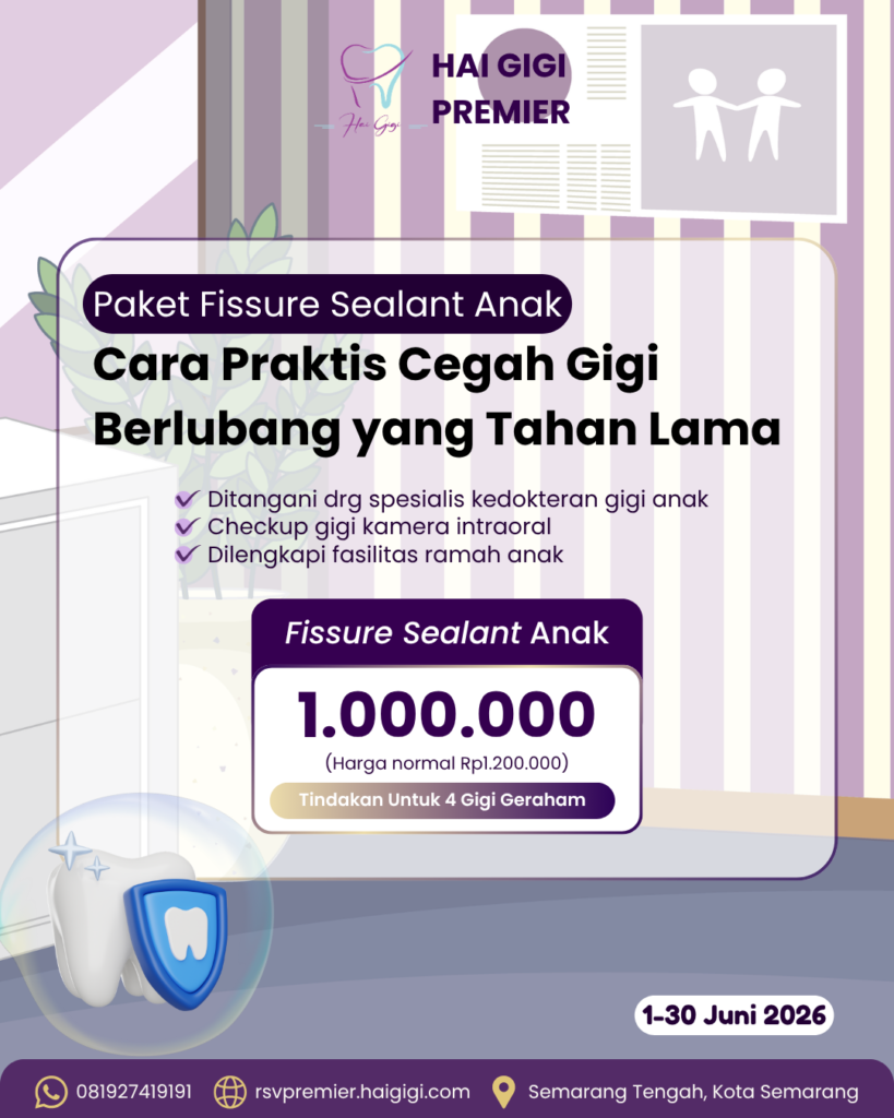 fissure-sealant-hai-gigi-premier