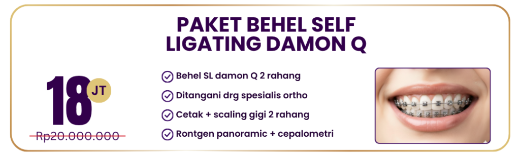 paket-behel-self-ligating-damon-q-hai-gigi-premier