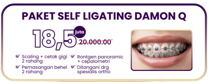 paket-behel-self-ligating-damon-q
