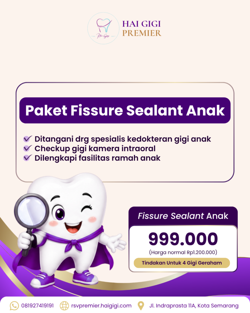 paket-fissure-sealant-anak-hai-gigi-premier