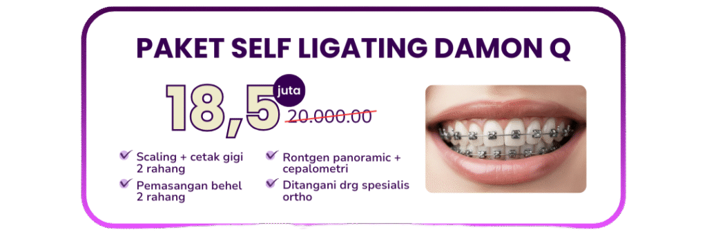 paket-self-ligating-damon-q-hai-gigi-premier