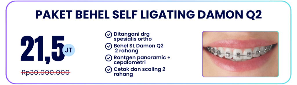 paket-self-ligating-damon-q2